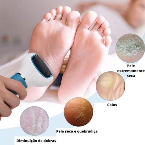 Lixa Elétrica para Pés com Refil USB Profissional